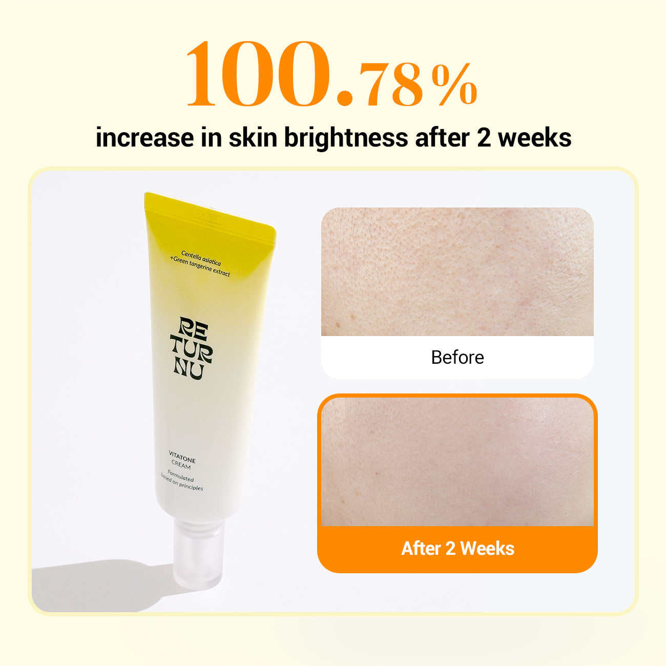 RETURNU VITATONE CREAM -  pele Hiper pigmentação- redução manchas