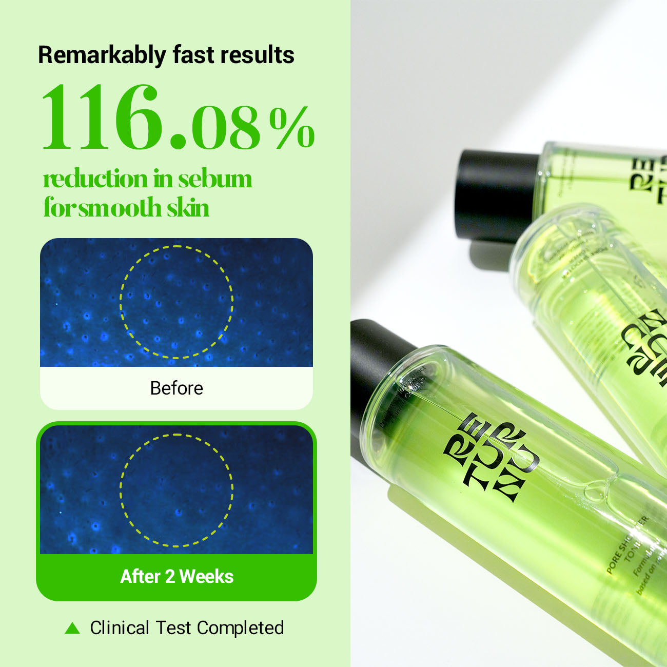 RETURNU PORESHOOTER TONER - pele oleosa e acneia