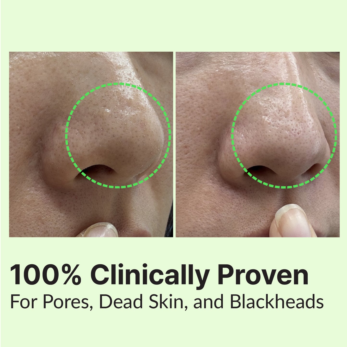 RETURNU-PORE SHOOTER GOMMAGE CLEASING BALM - pele oleosa e acneia